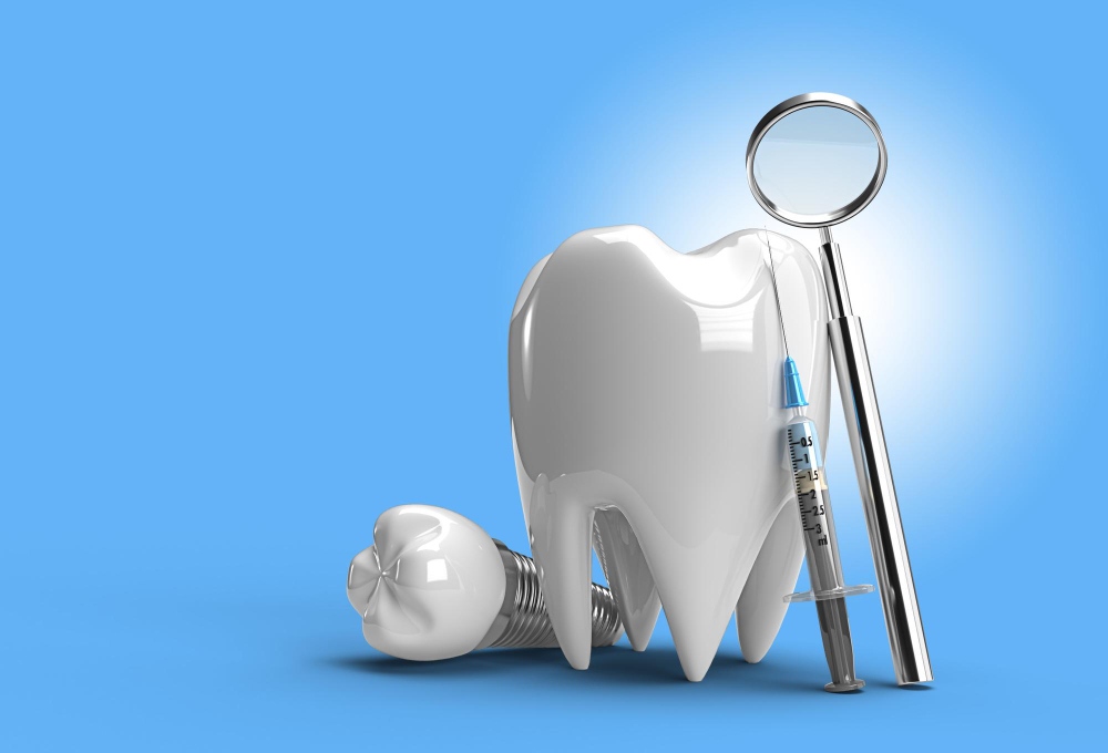 zubni implanti srbija