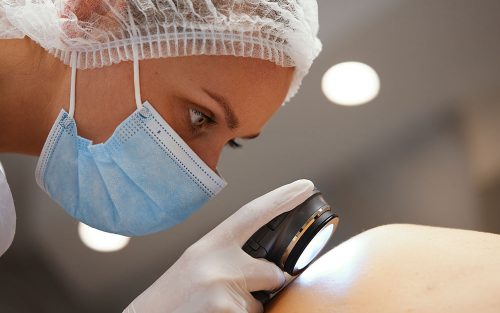 Pregled dermatologa