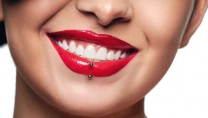 Hollywood smile