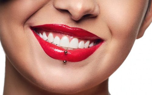 Hollywood smile