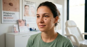 Pregled dermatologa devojka sa mladežom na licu.